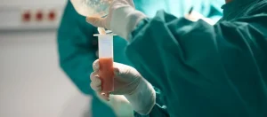 How Much Fat Can Liposuction Safely Remove?