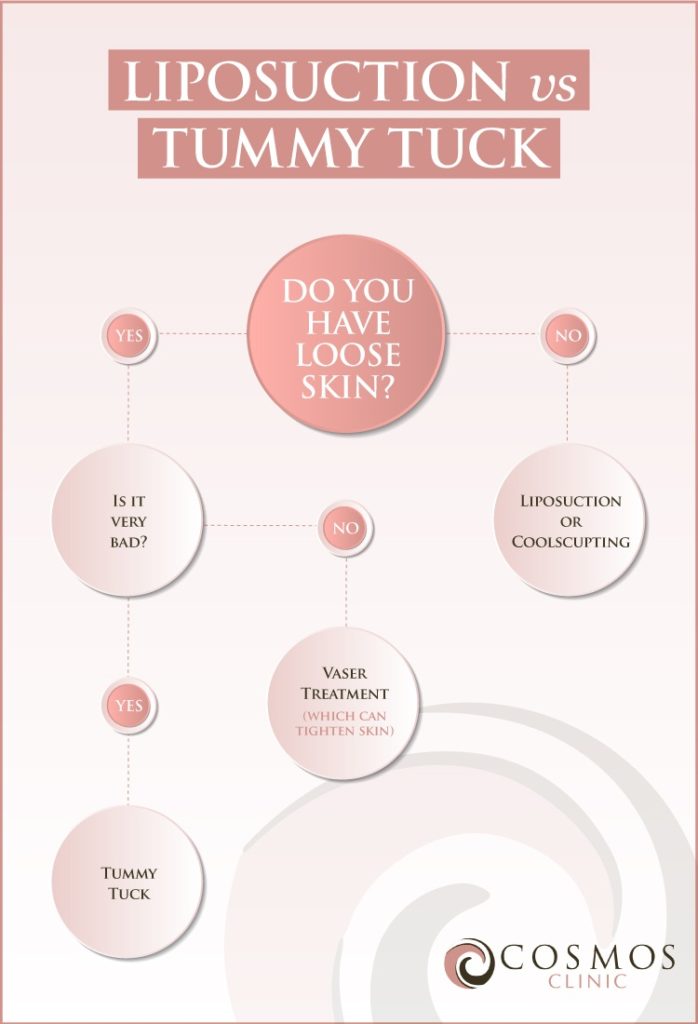 Tummy Tuck (Abdominoplasty) & Costs Sydney, Gold Coast, Canberra & Adelaide
