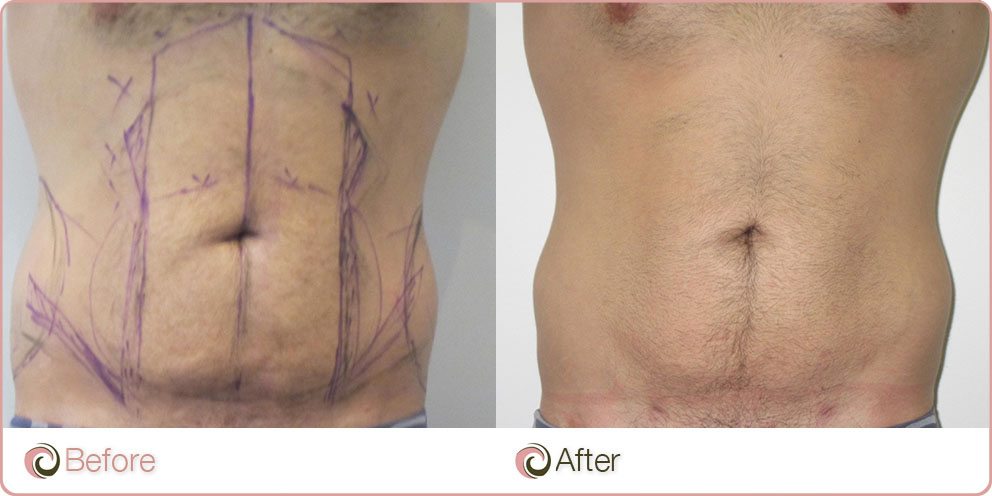 Can weight loss be the only symptom of cancer photo 4