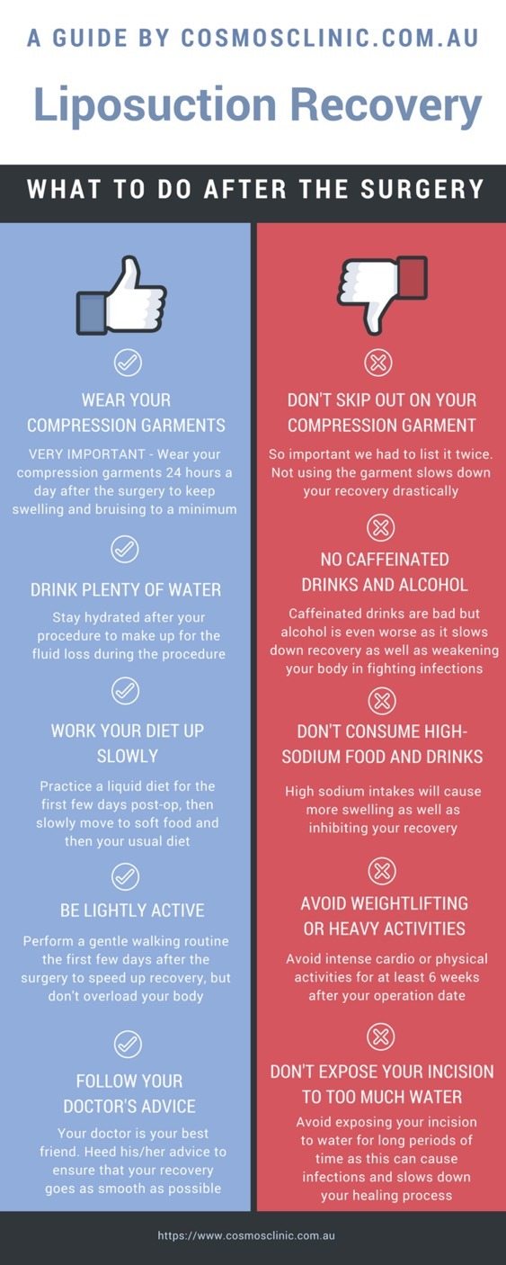 Liposuction A Complete Guide by Cosmos Clinic