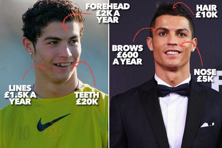 Are Cristiano Ronaldo's perfect looks enhanced by cosmetic ...