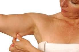 Diet pills lose 100 pounds image 4