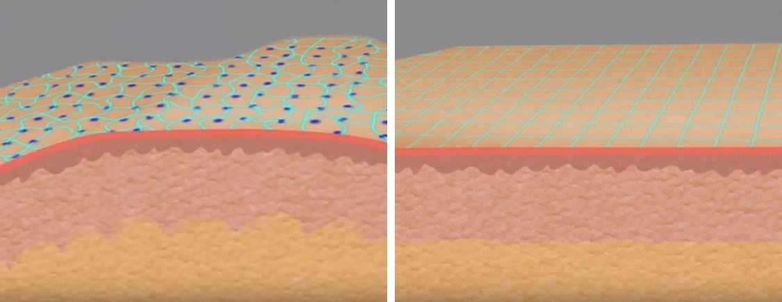 Two step invisible skin process
