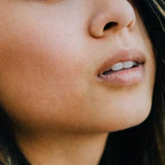 Silhouette Soft Face Lift