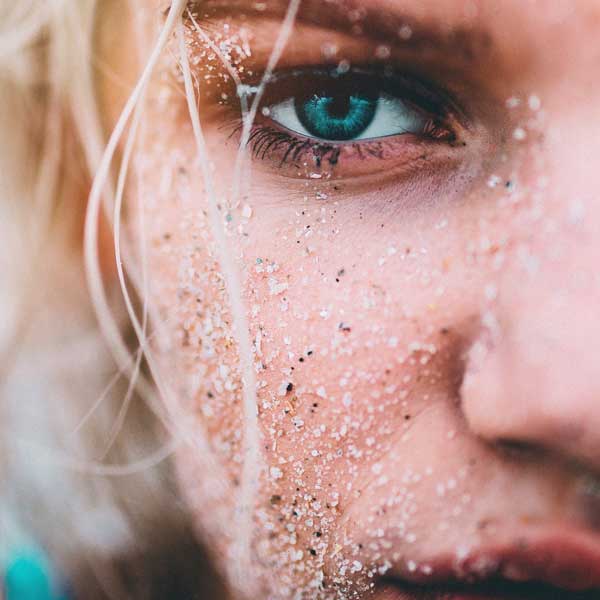 Acne Scars