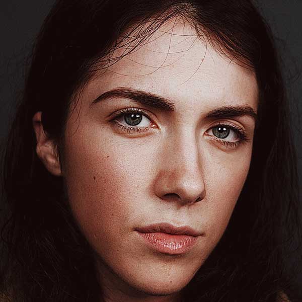 Capillaries & Rosacea