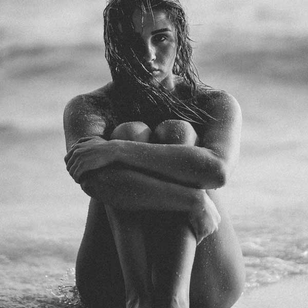 Scars