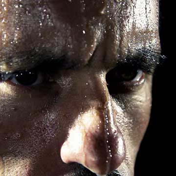 Excessive Sweating