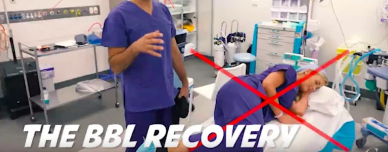How to Sleep After a BBL: Positions, Sitting and Early Recovery