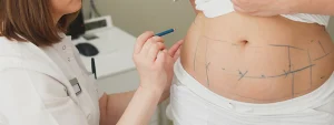 Vaser Liposuction vs Vaser High Definition Liposuction