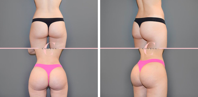 BBL Sports Illustrated Before and After