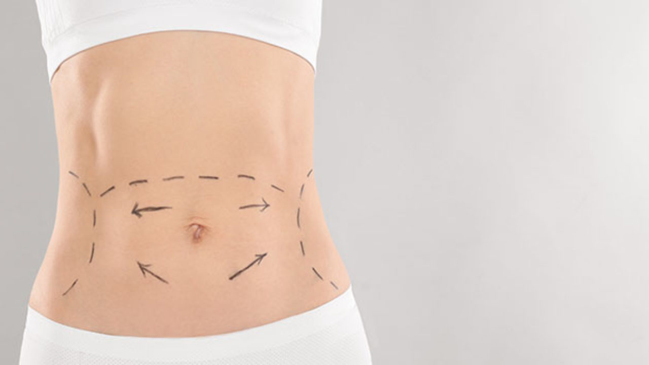 Liposuction in Cairo Egypt