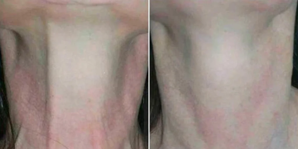 before and after