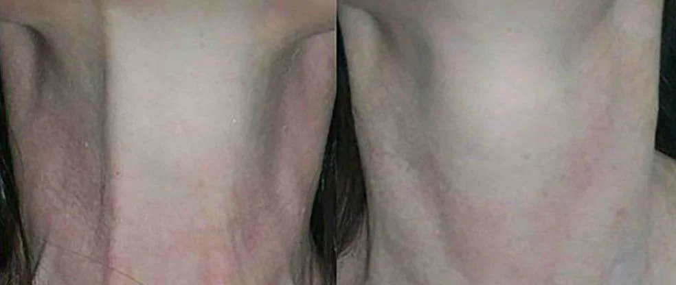 neck bands pre2024 before and after before and after
